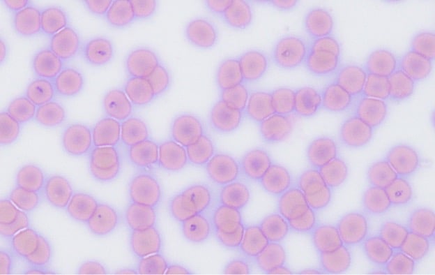 blood smear