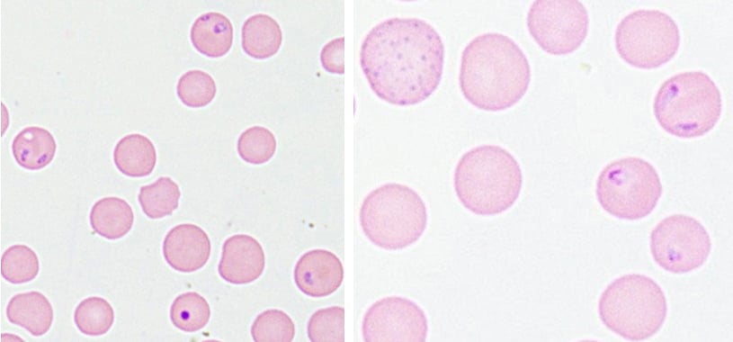 blood smear