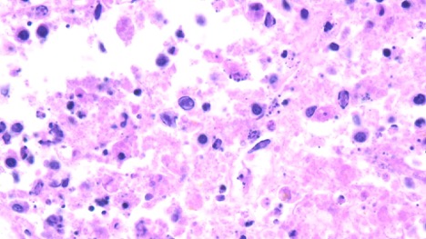 histology capture